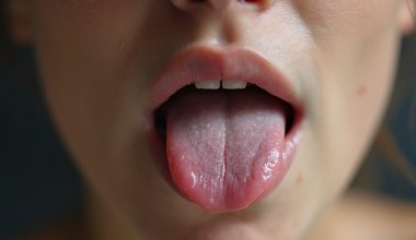 tongue position affects jaw headache