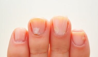 nail color reflects internal health